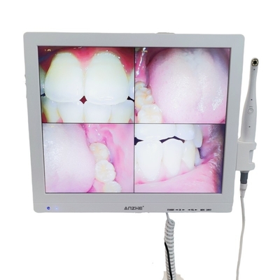 Wifi All In One Camera Orale Con Loudspeaker Screen LCD Scanner Dental Camera Orale