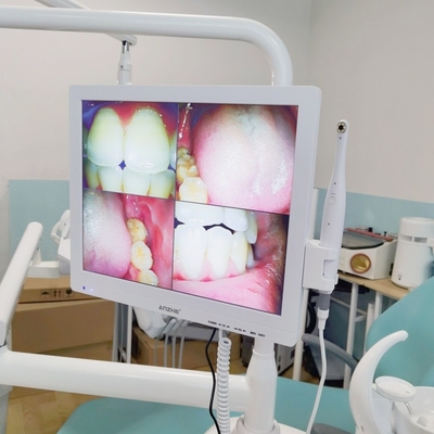 Wifi All In One Camera Orale Con Loudspeaker Screen LCD Scanner Dental Camera Orale
