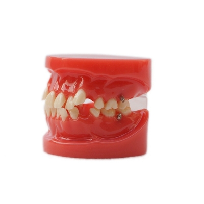 Formazione Uso dentale Modello didattico Modello ortopedico dentale funzionale senza supporto