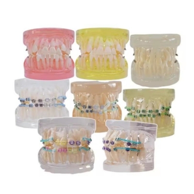 Modello di denti umani multicolori per studio dentale Modello di denti ortodontici con supporto