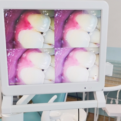 Endoscopio dentale con monitor da 17 pollici Wifi Fotocamera portatile dentale endoscopo intraorale fotocamera intraorale