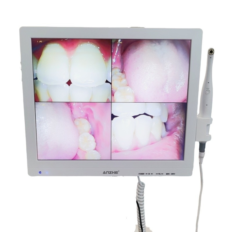 Wifi All In One Camera Orale Con Loudspeaker Screen LCD Scanner Dental Camera Orale