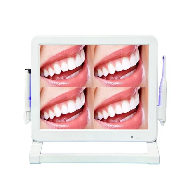 Fotocamera dentaria intraorale ad alto pixel 1 o 4 schermi Endoscopio dentario intraorale